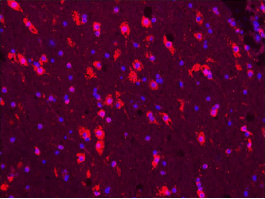 Insulin/glucagon in islets of mouse pancreas